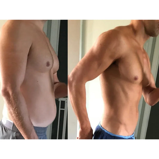 Tampa Bay Testosterone Replacement Therapy
